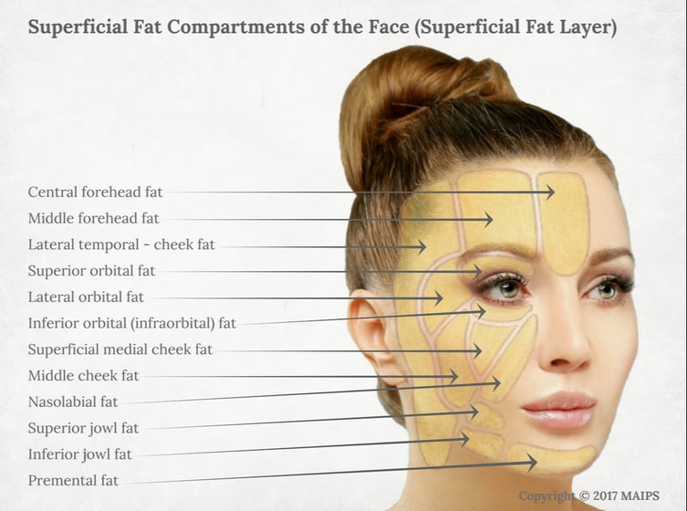Subcutaneous superficial fat layer in the face (superficial fat pockets/superficial fat pads): forehead, lateral temporal-cheek, lateral and inferior orbital, nasolabial etc   