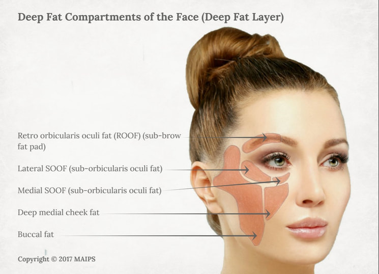 Deep fat layer of the face. Deep fat compartments (deep fat pockets): ROOF, lateral SOOF, medial SOOF, medial cheek, buccal fat