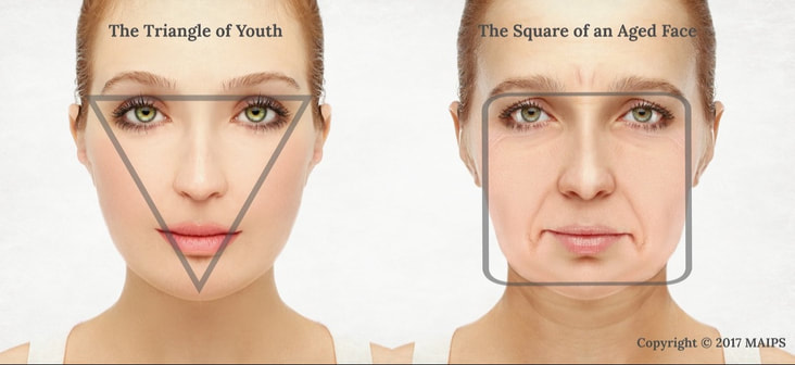 Facial shape changes with the age. Face starts sagging. The triangular shape in the youth becomes squared as we age. The triangle of youth turns into a square