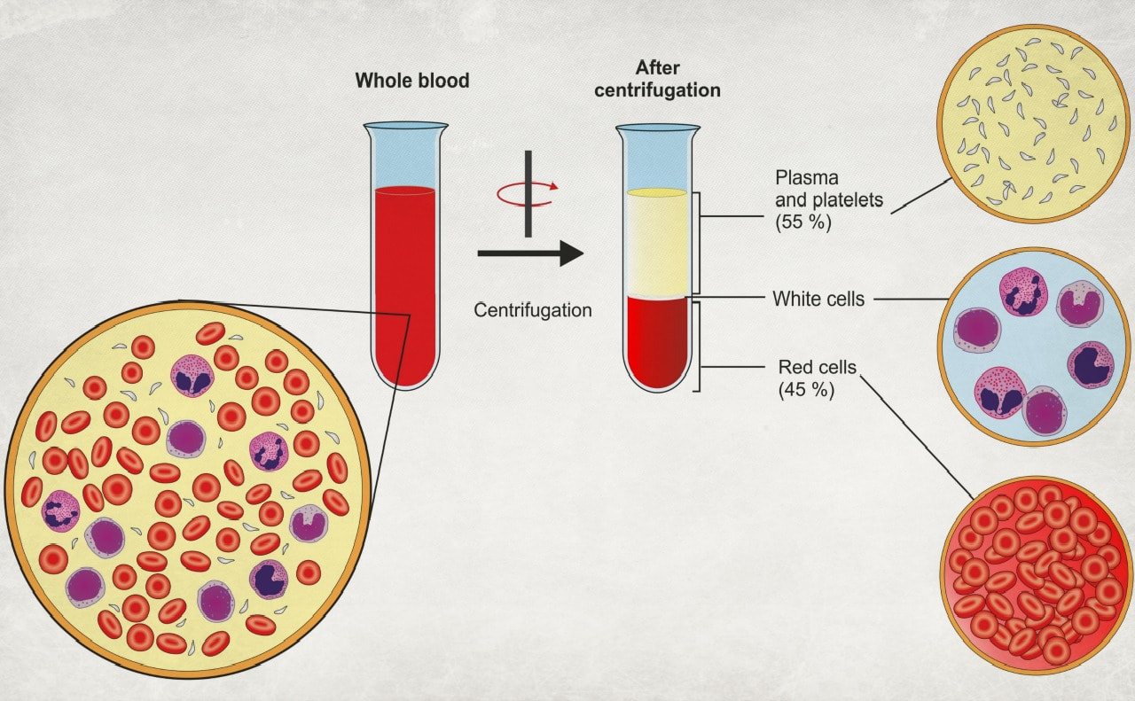 Platelet Rich Plasma is derived from whole blood by centrifugation
